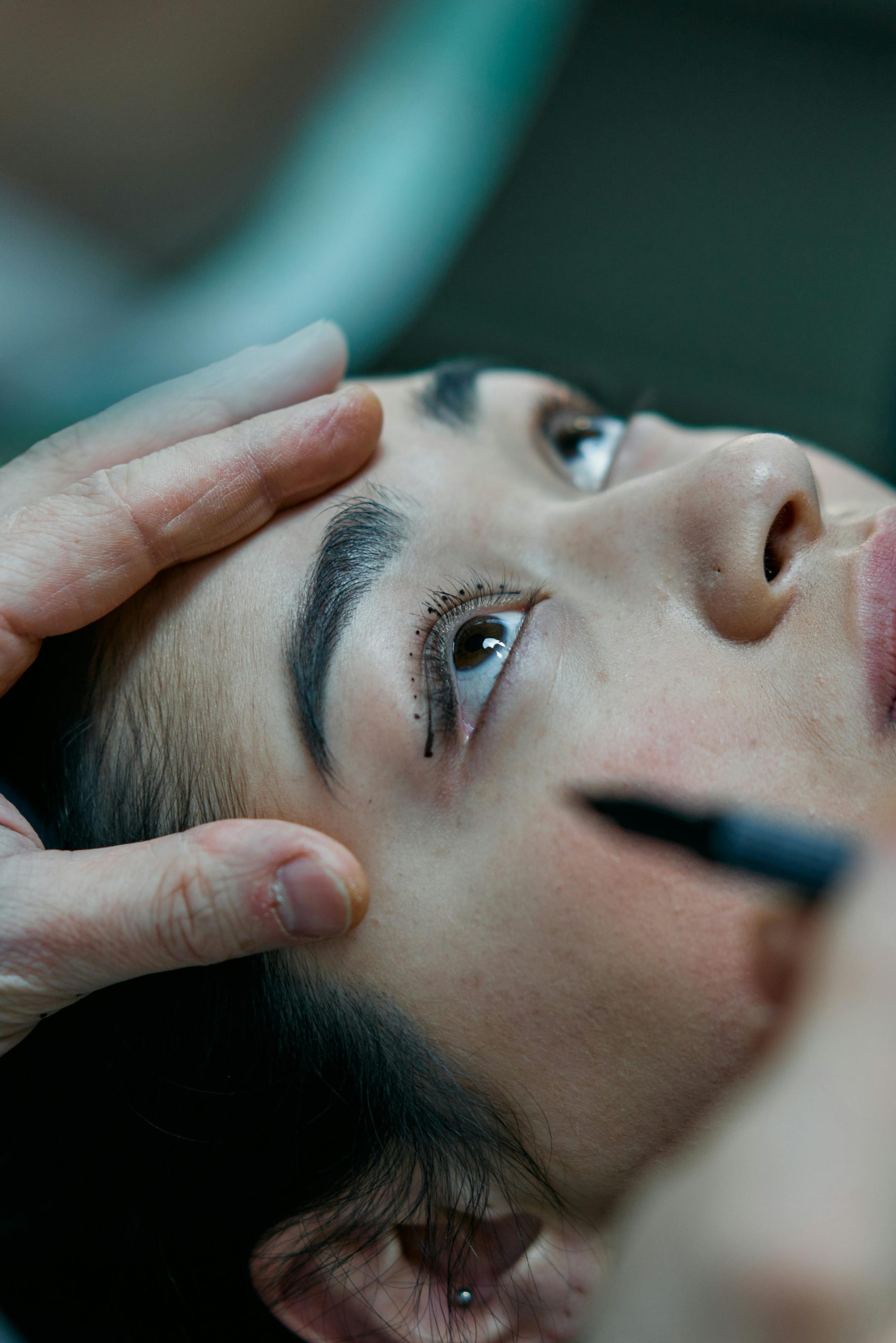 rinoplastia en Madrid